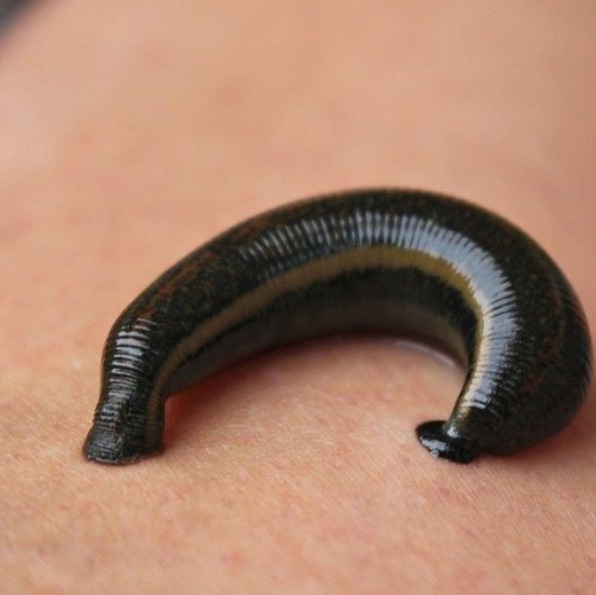 Leech therapy treatment near Koyambedu  main image
