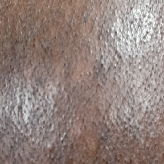 Vibha skin