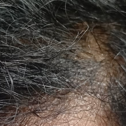 Vibha skin