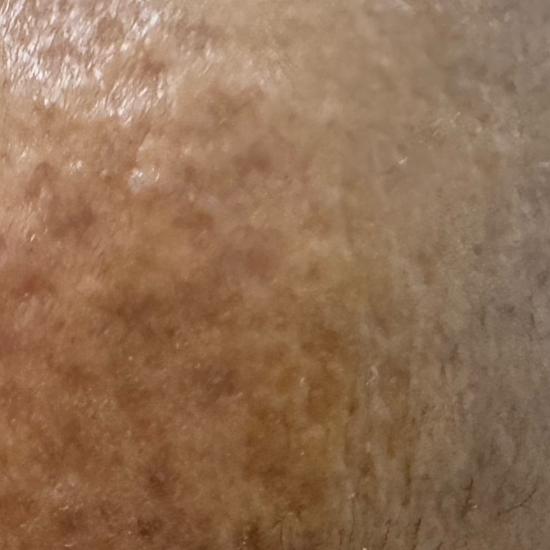 Vibha skin
