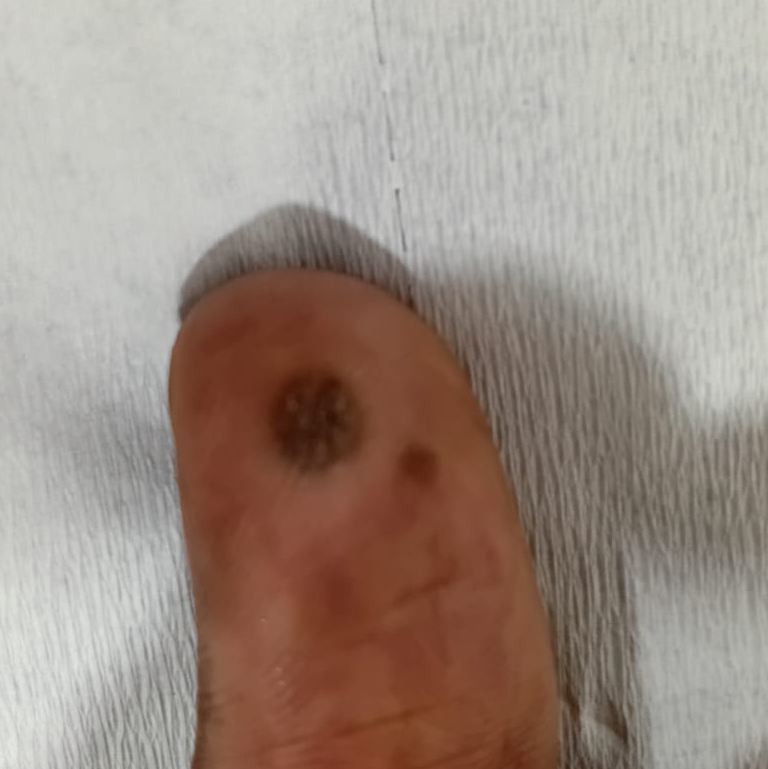 Vibha skin