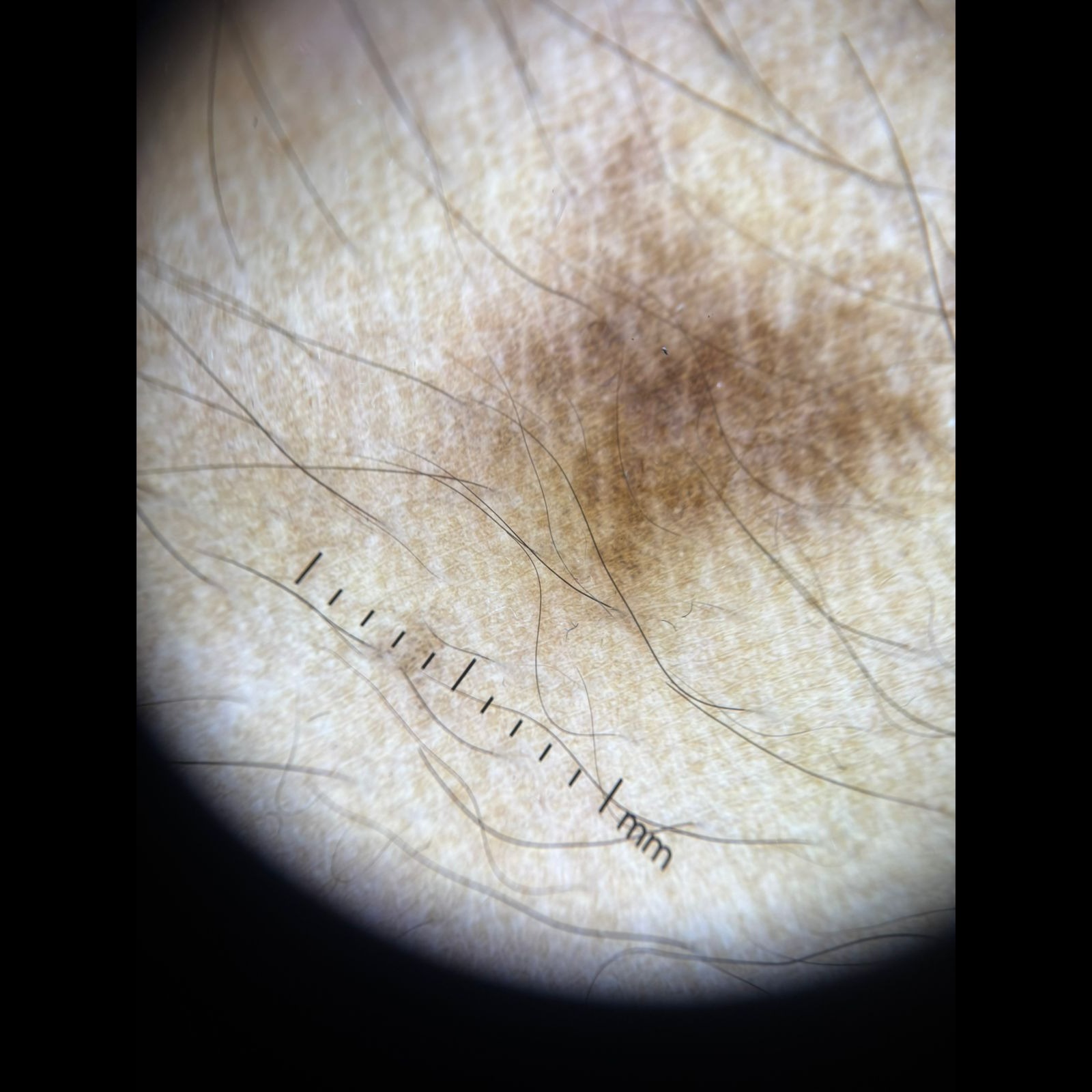 Dermatolog