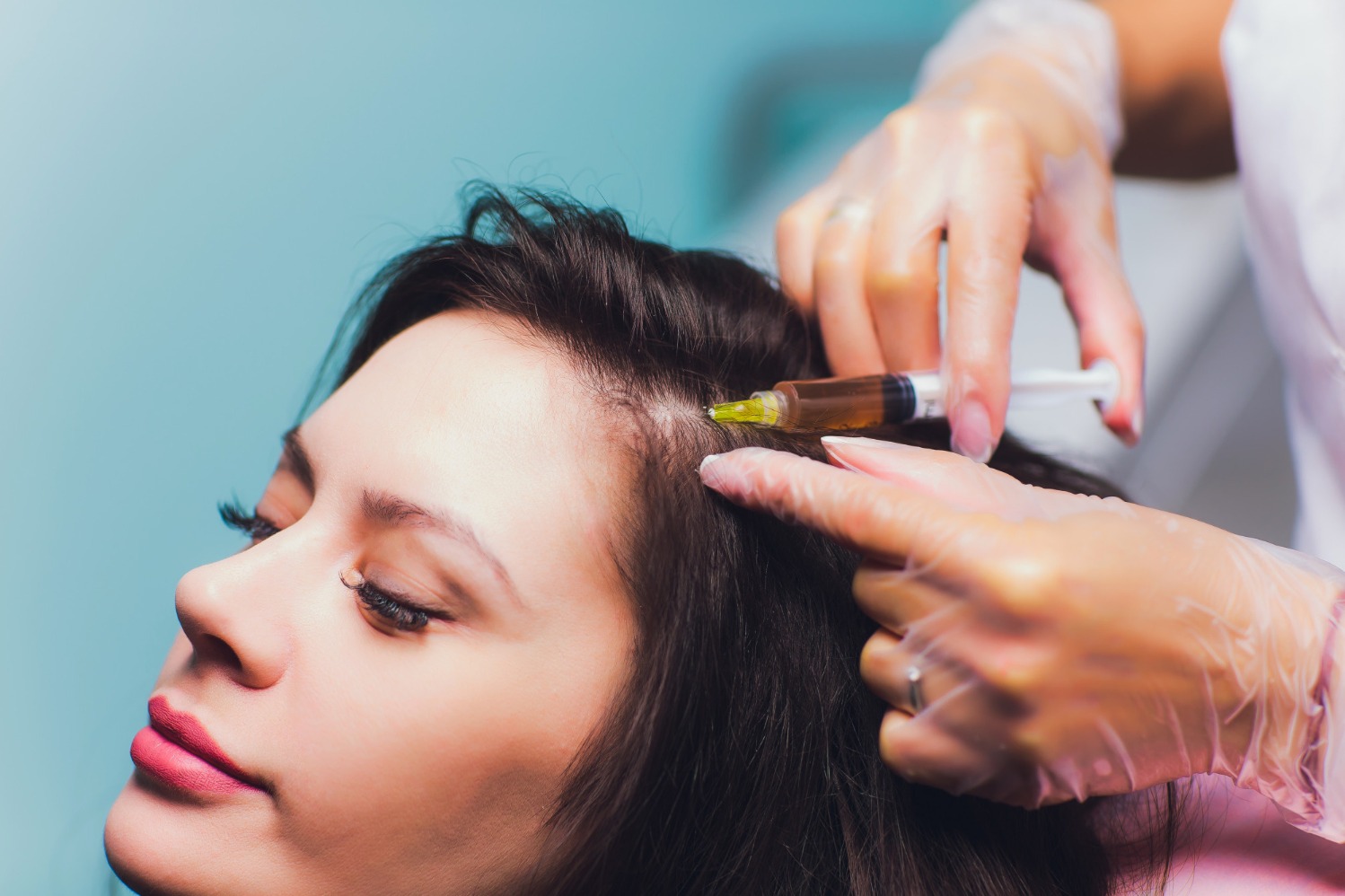Platelet Rich Plasma Therapy in Chennai for Joint and Tissue Recovery main image