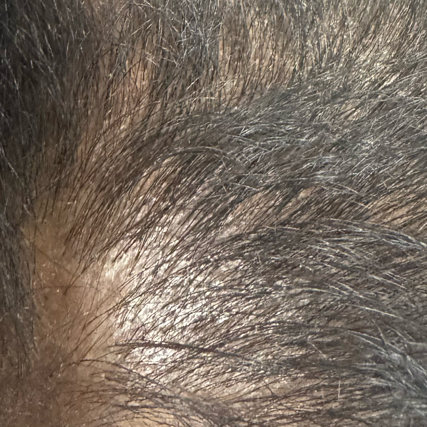 Vibha skin