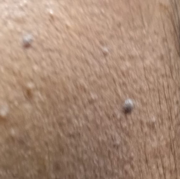 Vibha skin