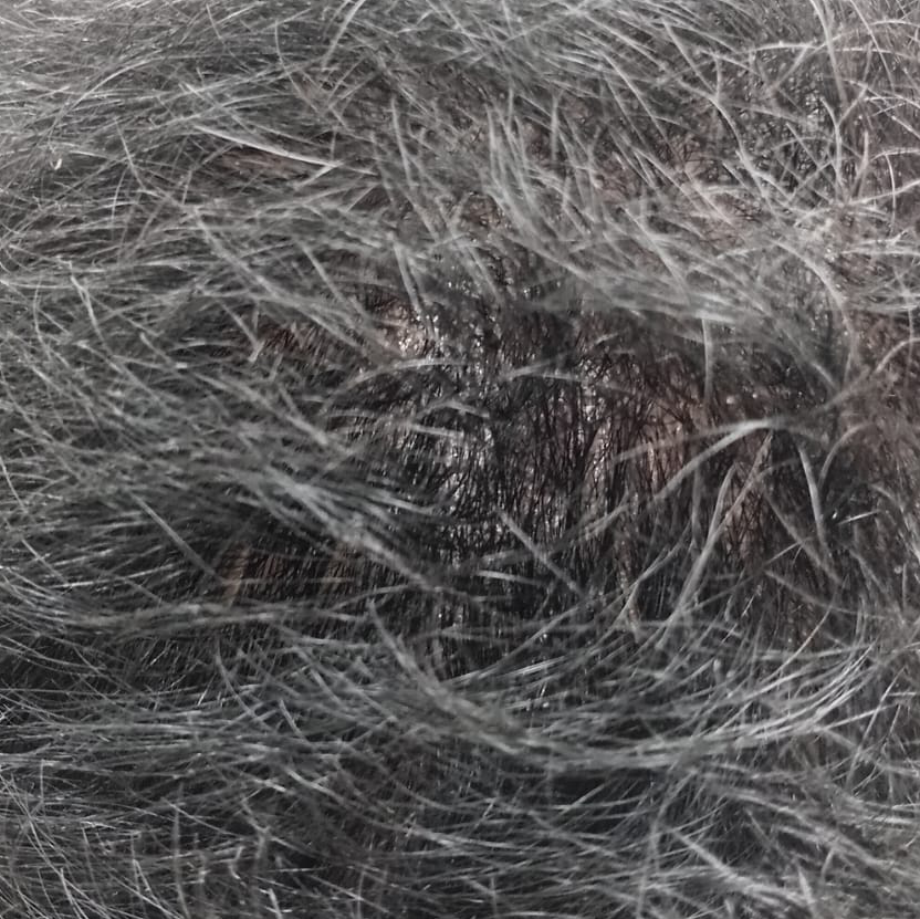 Vibha skin