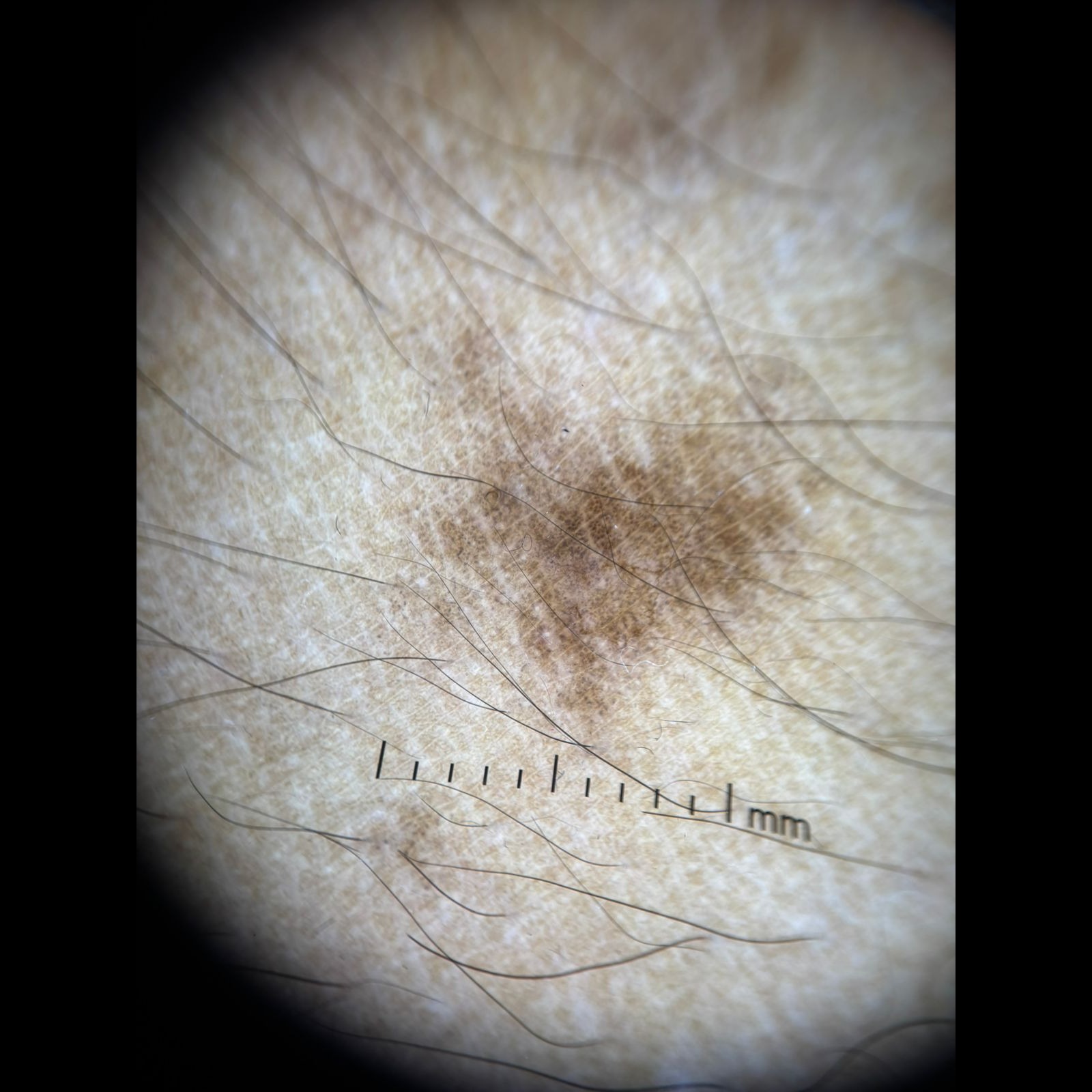 Dermatolog