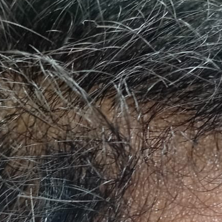Vibha skin