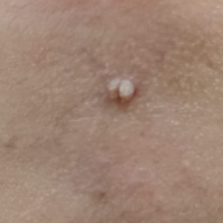 Vibha skin