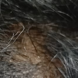 Vibha skin