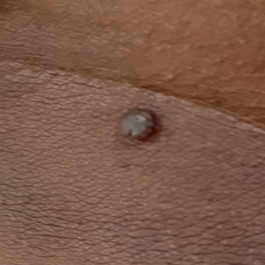 Vibha skin
