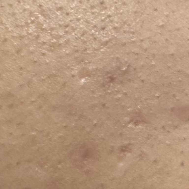 Vibha skin