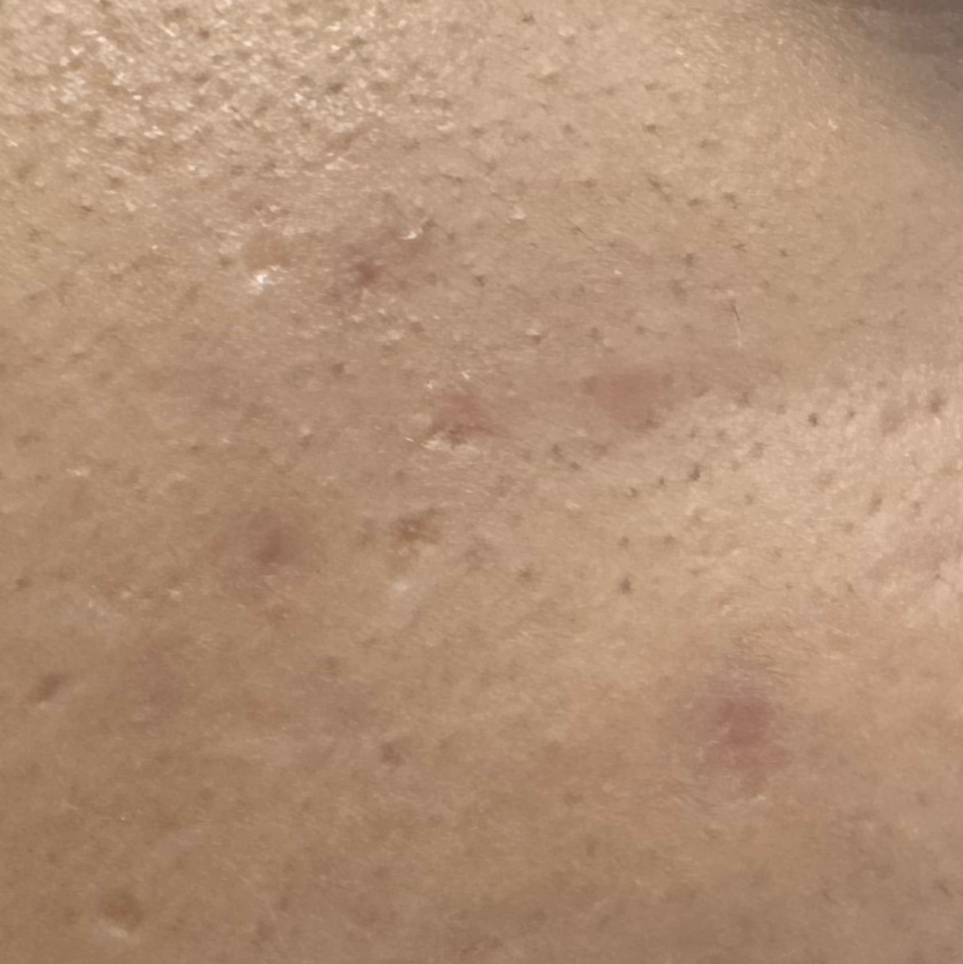 Vibha skin