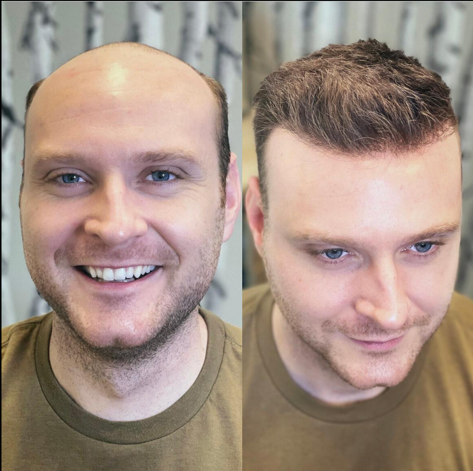 Men Hair P