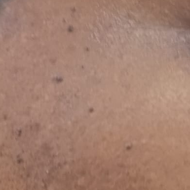 Vibha skin