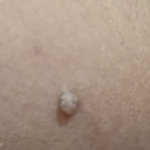 Vibha skin