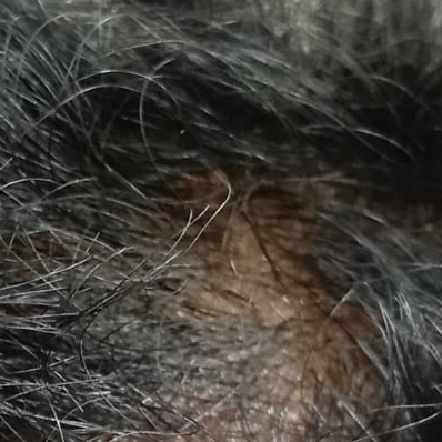 Vibha skin