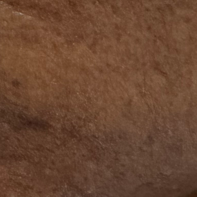 Vibha skin