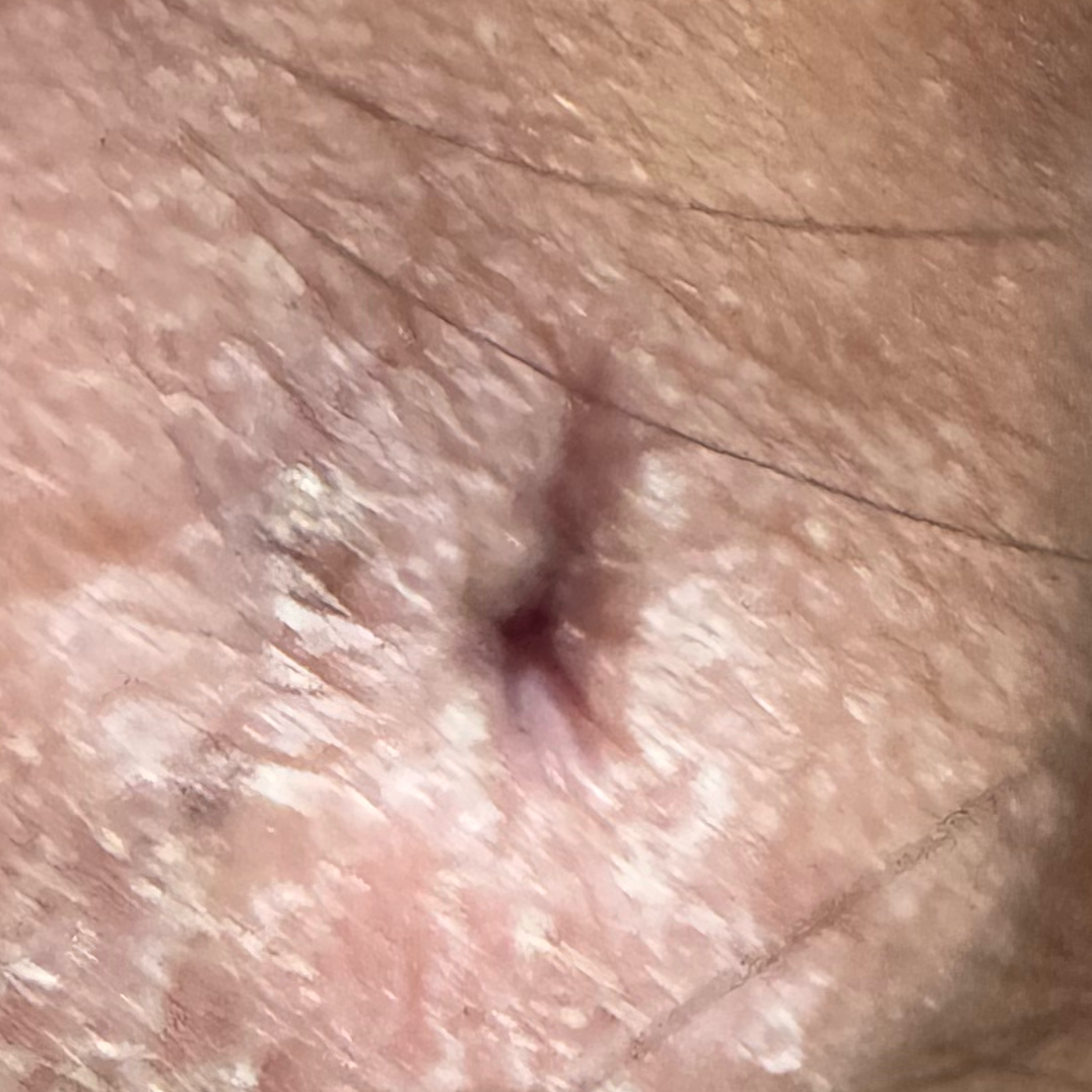 Vibha skin
