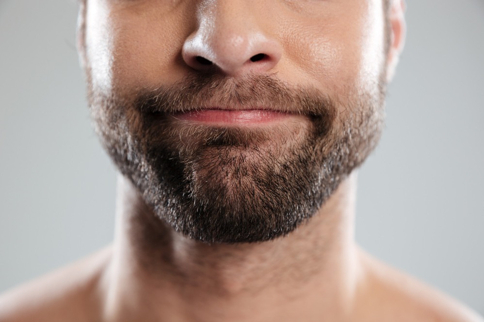 Beard Transplant in Adyar – Creating a Fuller and More Defined Look main image