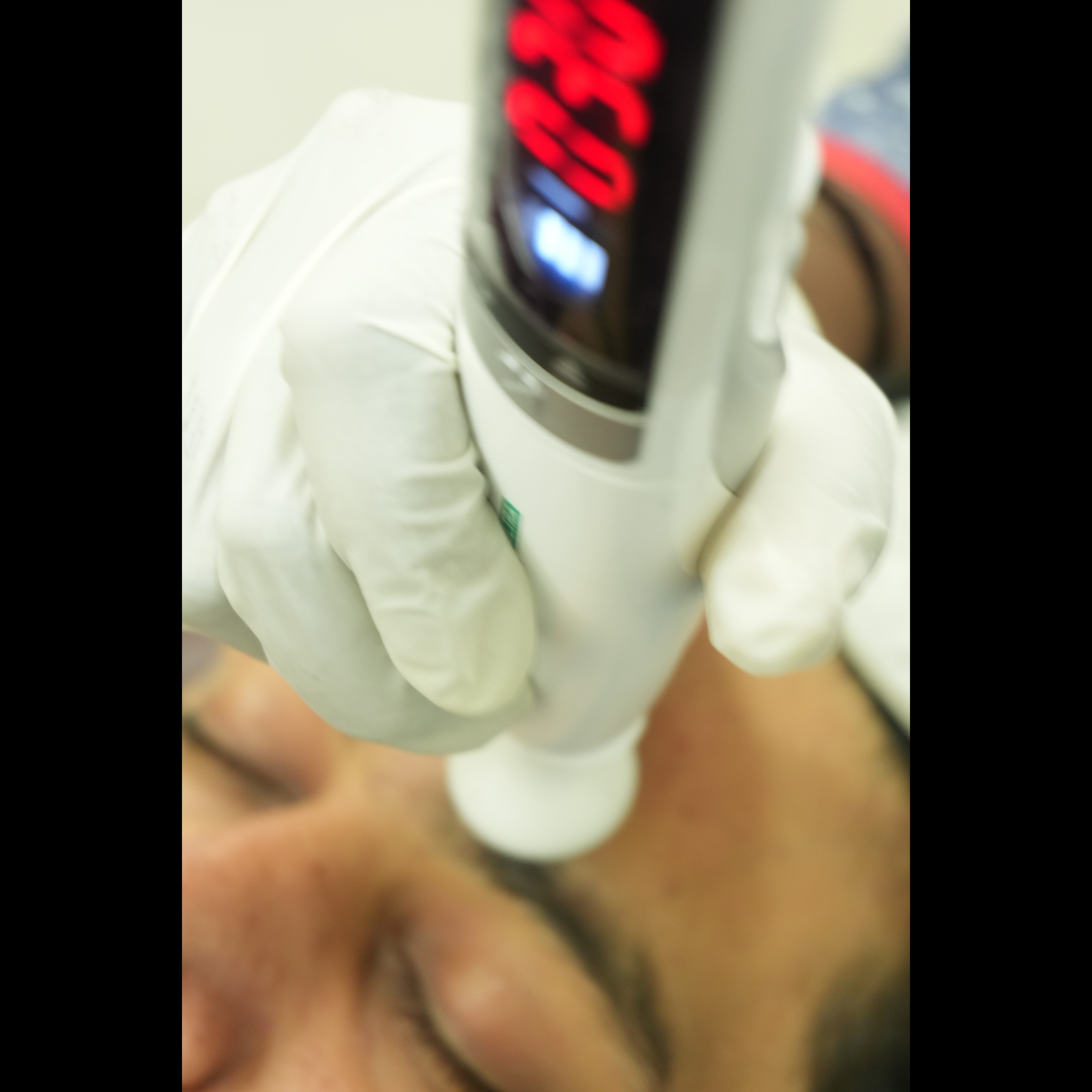 Dermatology clinic Trichy main image