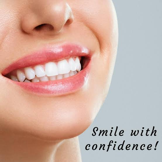 Veneers cost bandra mumbai main image