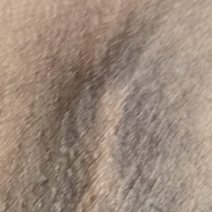 Vibha skin
