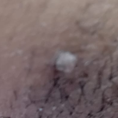 Vibha skin