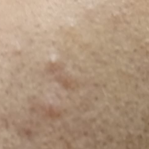 Vibha skin