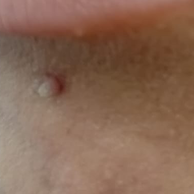 Vibha skin