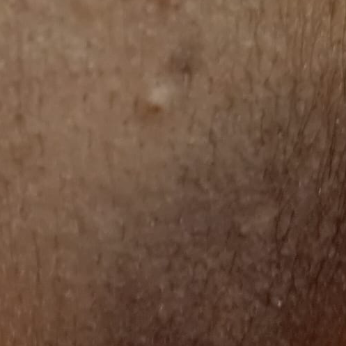 Vibha skin