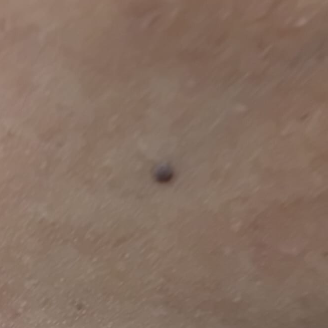 Vibha skin