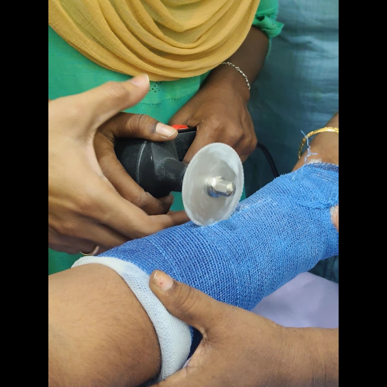 Orthopedic care center KK Nagar Trichy main image