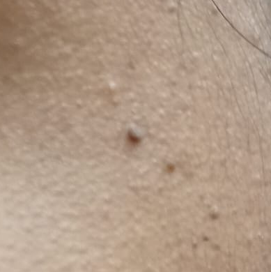 Vibha skin
