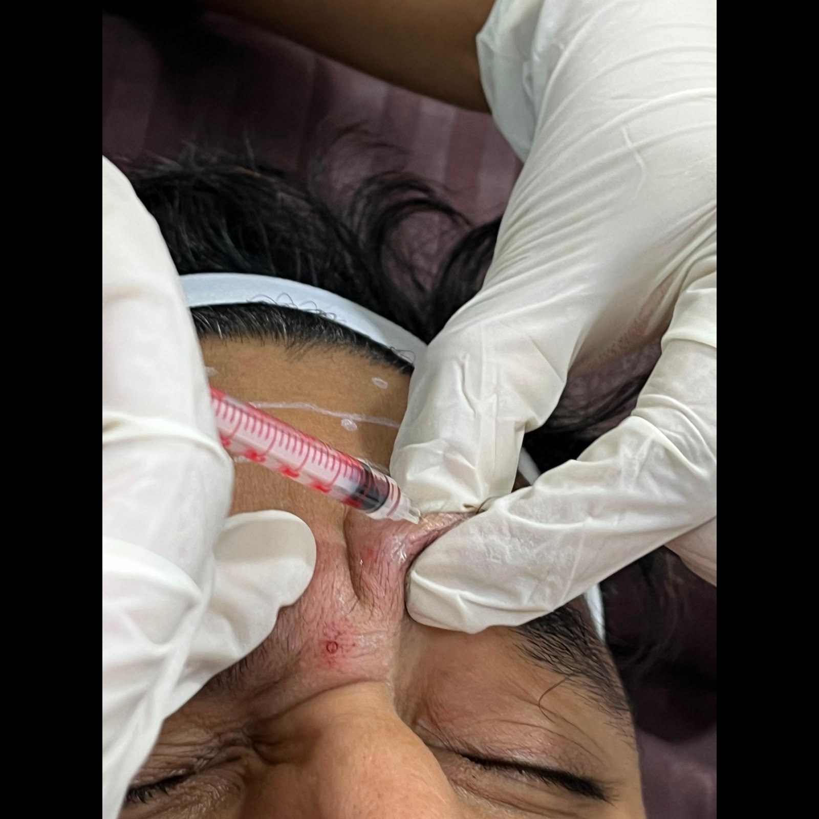 Skin infection treatment Trichy main image