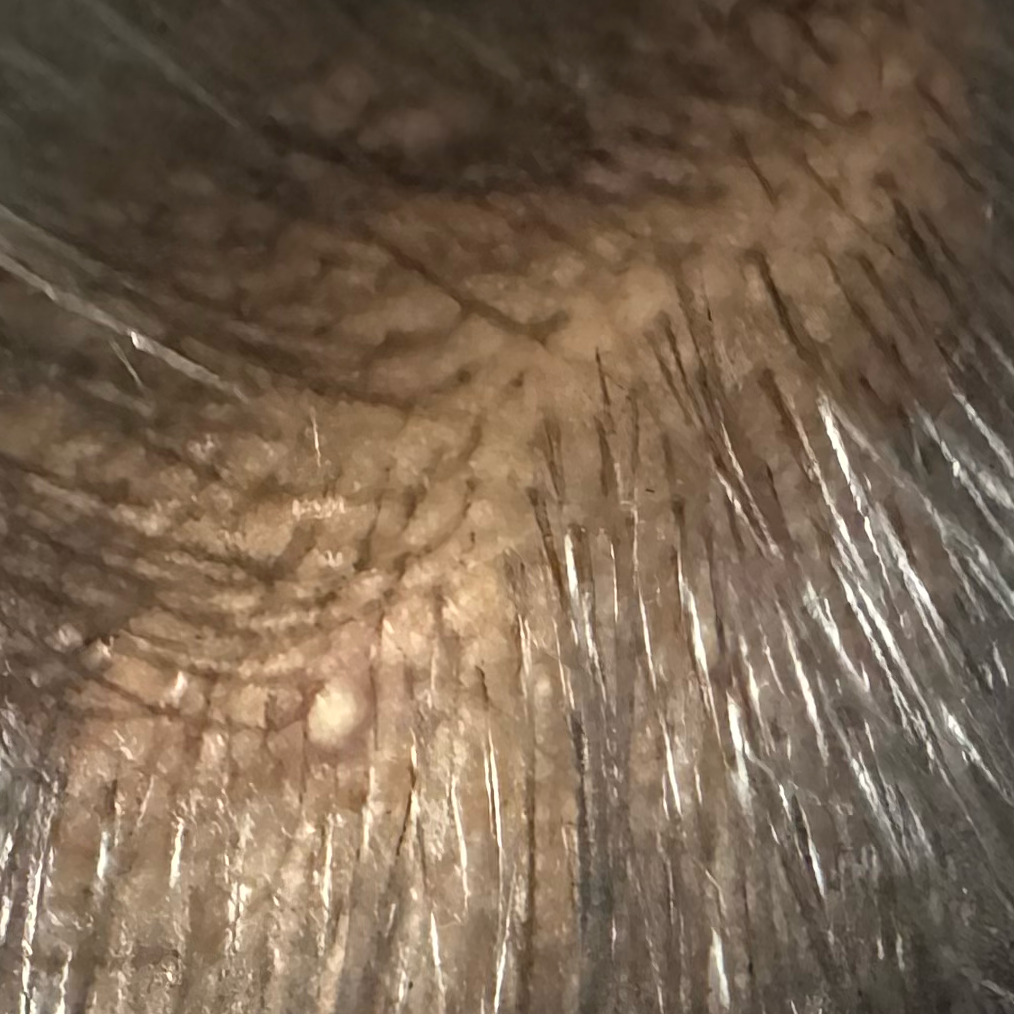 Vibha skin