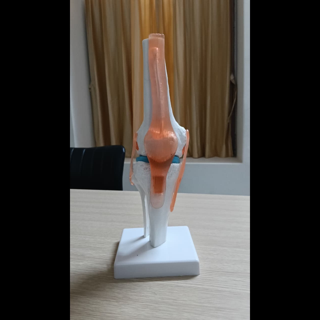 Joint replacement Thillai Nagar main image
