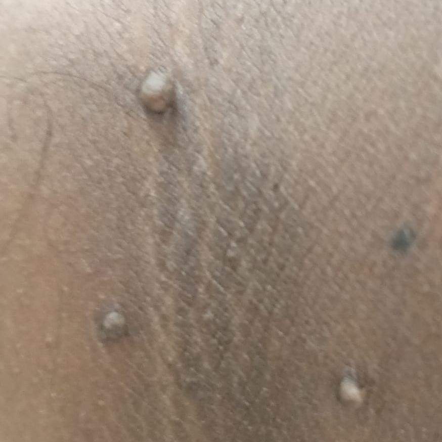 Vibha skin