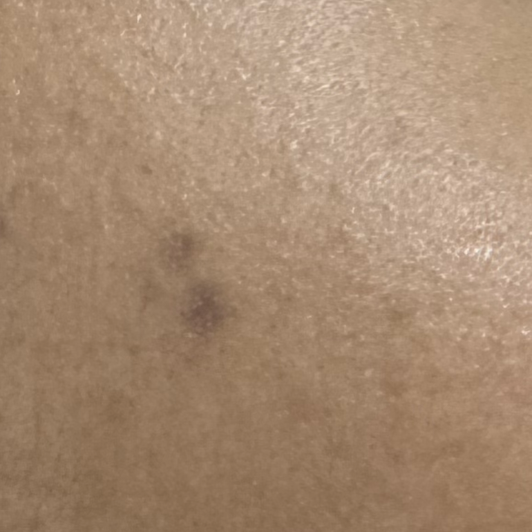 Vibha skin