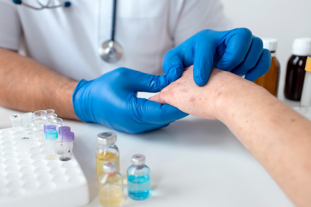 Skin Allergy Doctor Near Me: How to Identify, Manage, and Prevent Common Skin Allergies main image