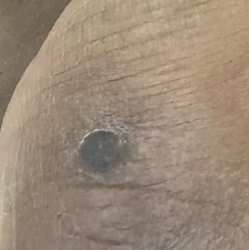 Vibha skin
