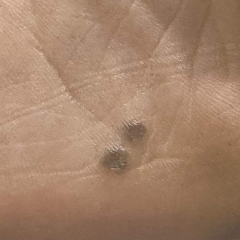 Vibha skin