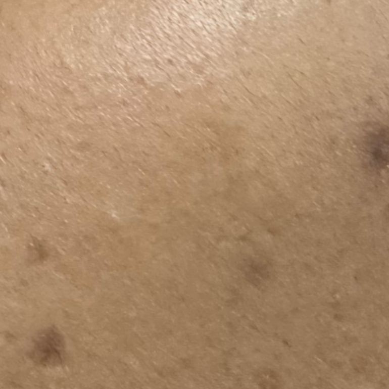 Vibha skin