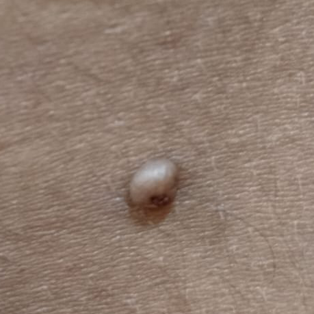 Vibha skin
