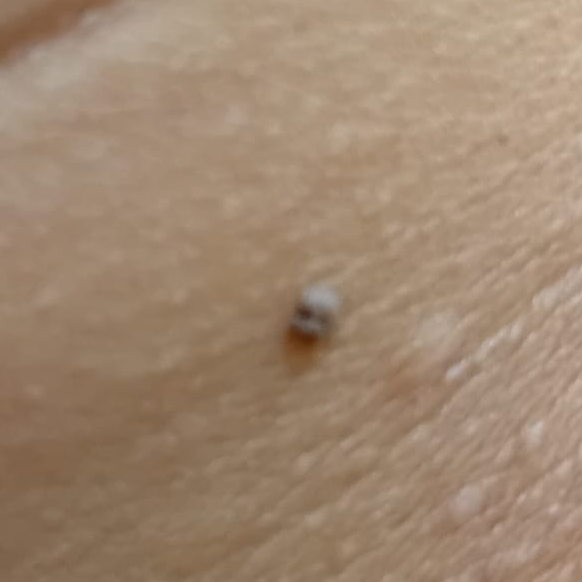 Vibha skin