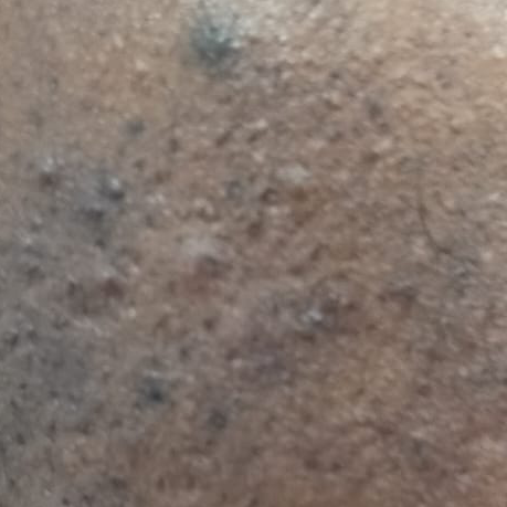 Vibha skin