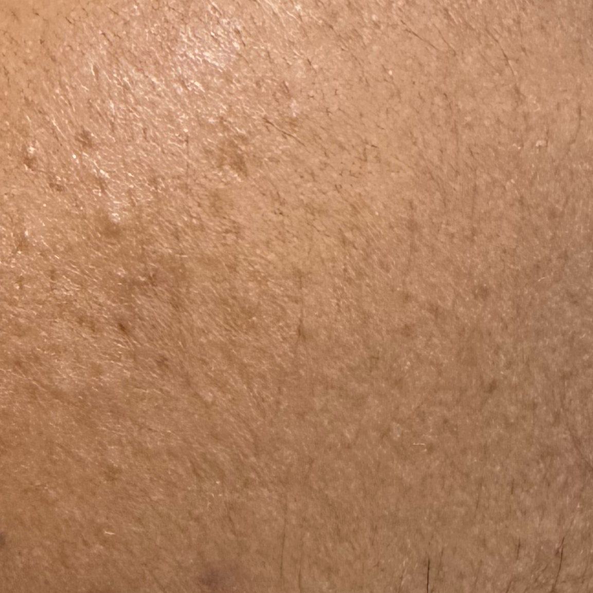 Vibha skin