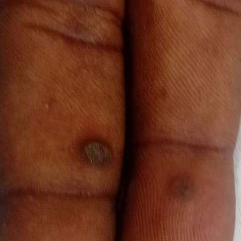 Vibha skin