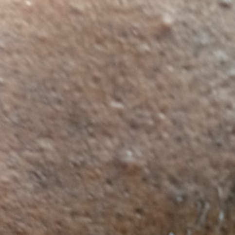 Vibha skin