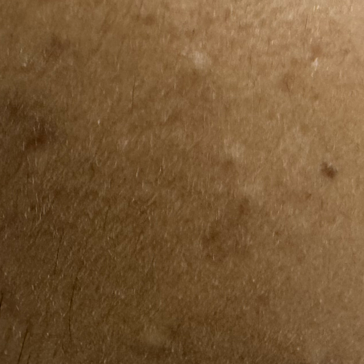 Vibha skin